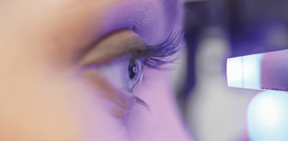 Trabeculoplastia Seletiva a Laser – SLT